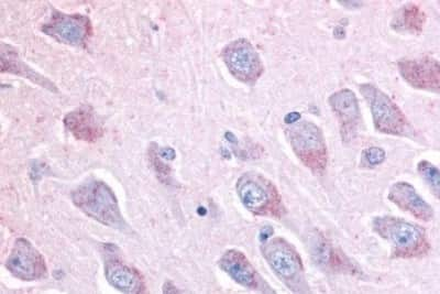 Immunohistochemistry-Paraffin: LINGO-1 Antibody [NBP3-14392]